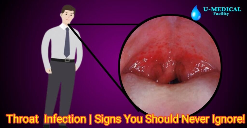 Throat Infection | Signs You Should Never Ignore!