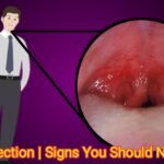 Throat Infection | Signs You Should Never Ignore!